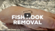 Fishhook Removal Trick VIDEO