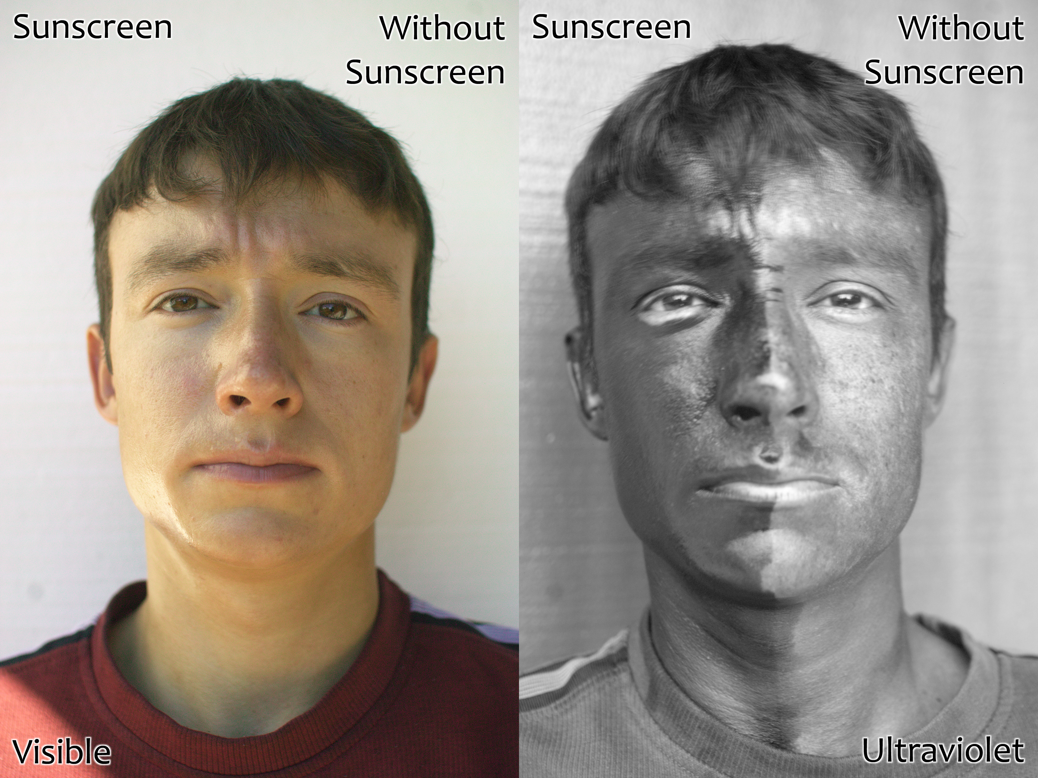 Demonstration of the effect of sunscreen. The man's face has sunscreen on his right only.